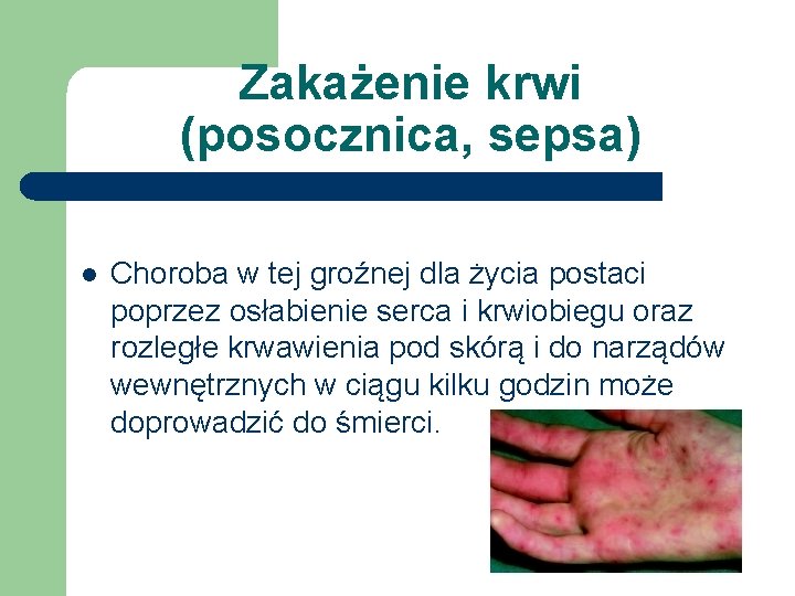 Zakażenie krwi (posocznica, sepsa) l Choroba w tej groźnej dla życia postaci poprzez osłabienie