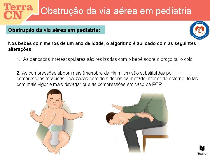 Obstrução da via aérea em pediatria: Nos bebés com menos de um ano de