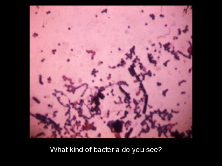 What kind of bacteria do you see? 