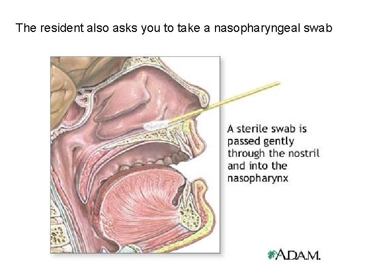 The resident also asks you to take a nasopharyngeal swab 