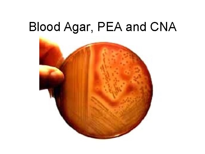 Blood Agar, PEA and CNA 