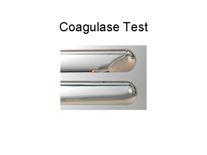 Coagulase Test 