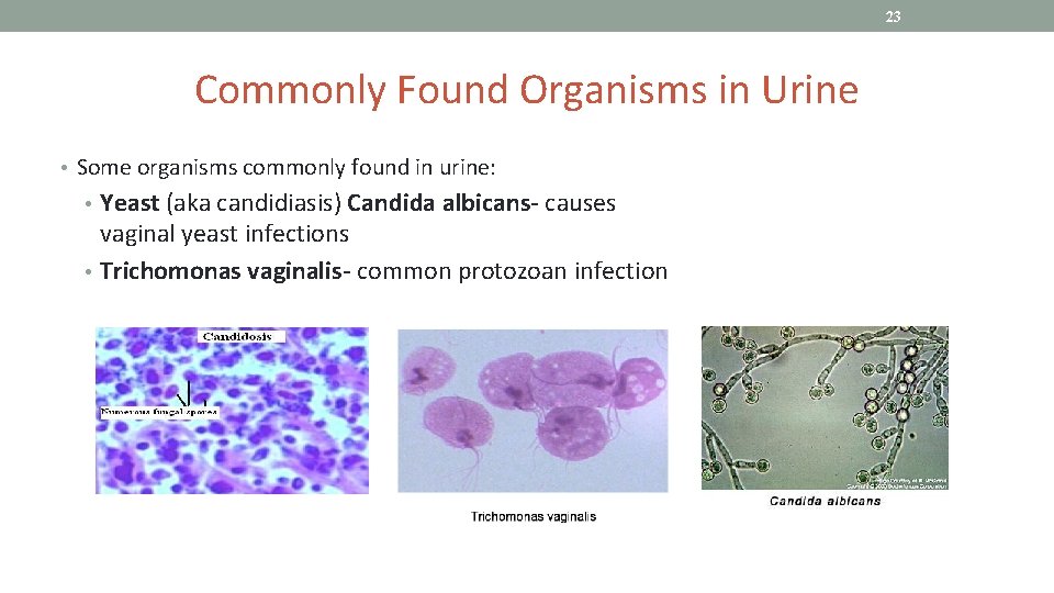 23 Commonly Found Organisms in Urine • Some organisms commonly found in urine: •