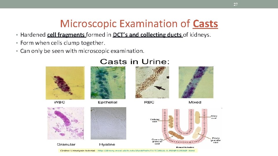 27 Microscopic Examination of Casts • Hardened cell fragments formed in DCT’s and collecting