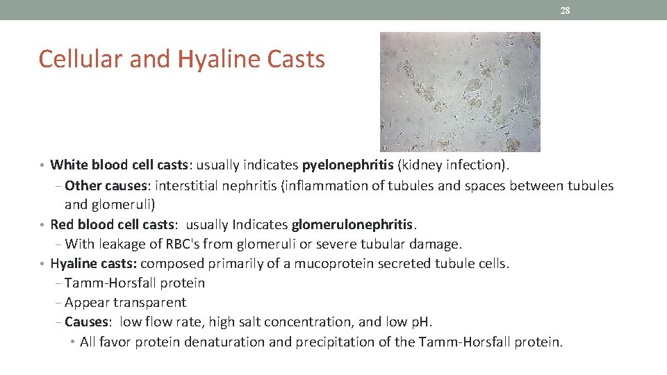 28 Cellular and Hyaline Casts • White blood cell casts: usually indicates pyelonephritis (kidney