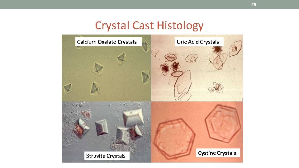 29 Crystal Cast Histology 