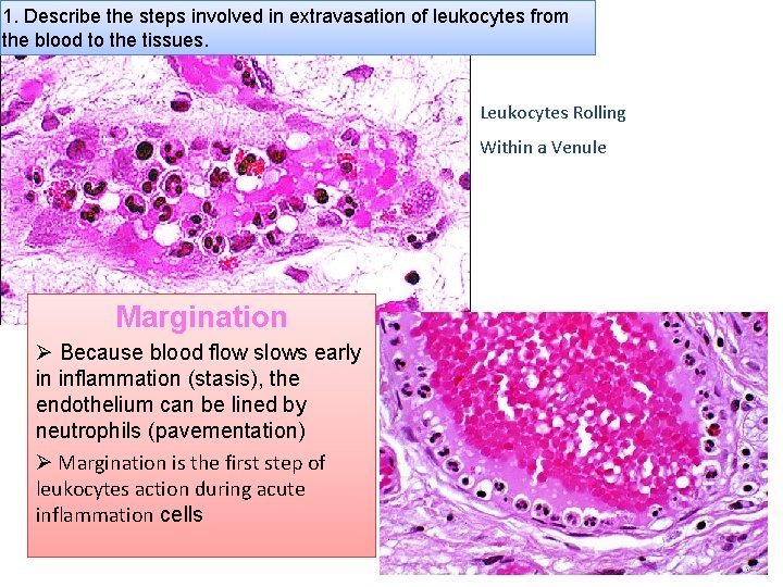 1. Describe the steps involved in extravasation of leukocytes from the blood to the
