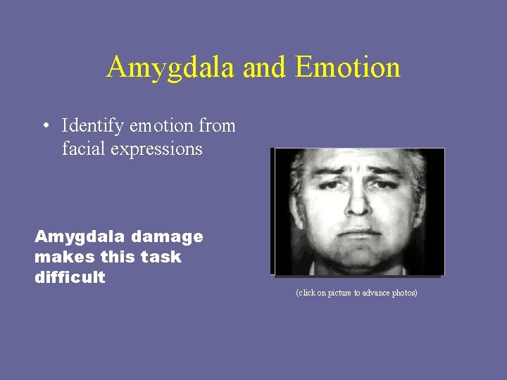 Amygdala and Emotion • Identify emotion from facial expressions Amygdala damage makes this task