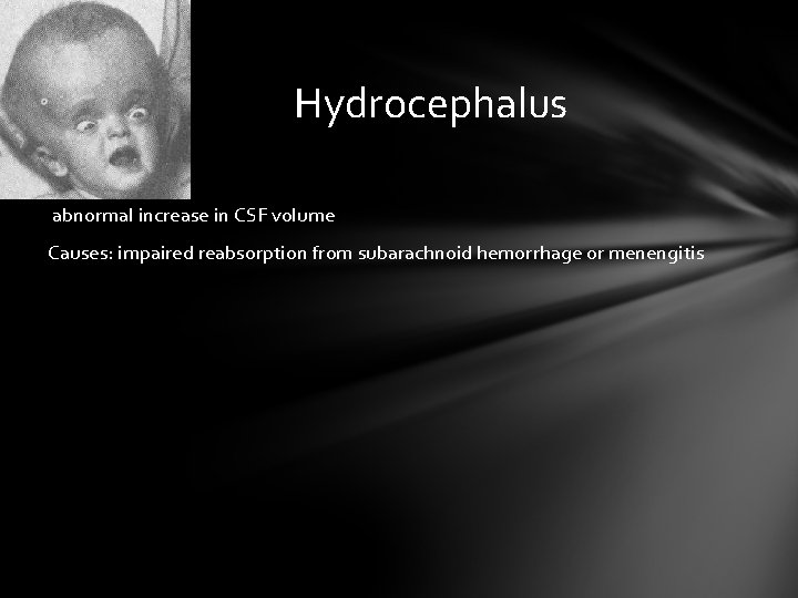 Hydrocephalus abnormal increase in CSF volume Causes: impaired reabsorption from subarachnoid hemorrhage or menengitis