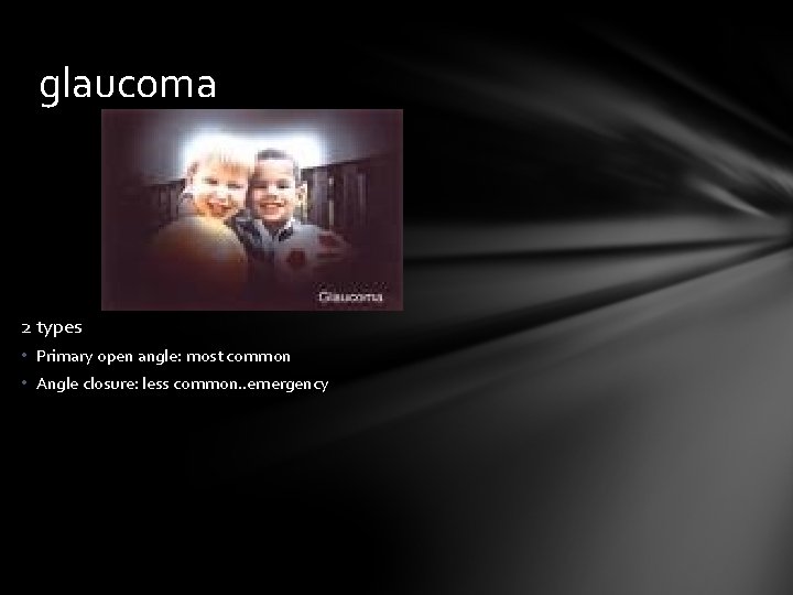 glaucoma 2 types • Primary open angle: most common • Angle closure: less common.