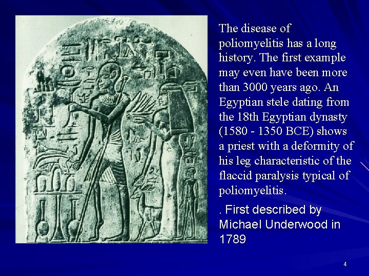 The disease of poliomyelitis has a long history. The first example may even have