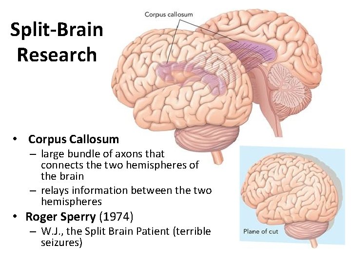 Split-Brain Research • Corpus Callosum – large bundle of axons that connects the two