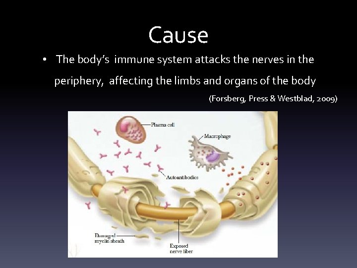 Cause • The body’s immune system attacks the nerves in the periphery, affecting the