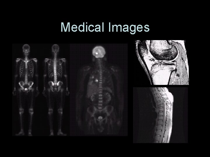 Medical Images Digtial Image Processing, Spring 2006 4 