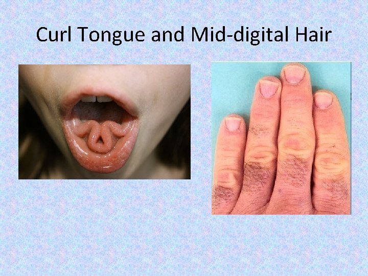 Curl Tongue and Mid-digital Hair 