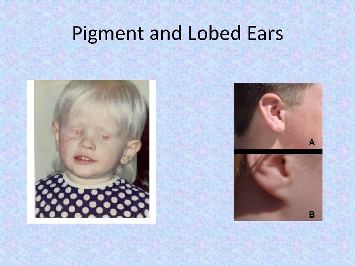 Pigment and Lobed Ears 