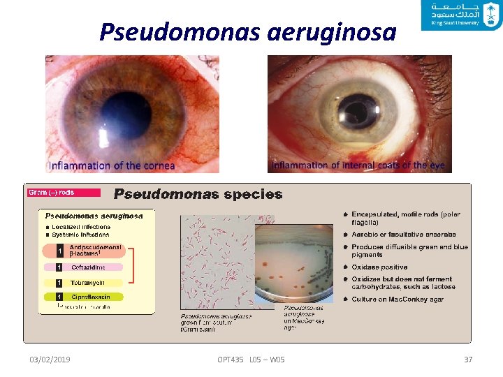 Pseudomonas aeruginosa 03/02/2019 OPT 435 L 05 – W 05 37 