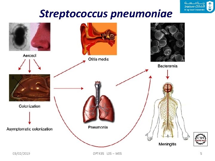 Streptococcus pneumoniae 03/02/2019 OPT 435 L 05 – W 05 5 