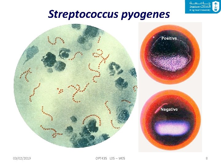 Streptococcus pyogenes 03/02/2019 OPT 435 L 05 – W 05 8 