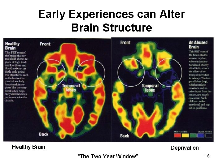 Early Experiences can Alter Brain Structure Healthy Brain Deprivation “The Two Year Window” 16
