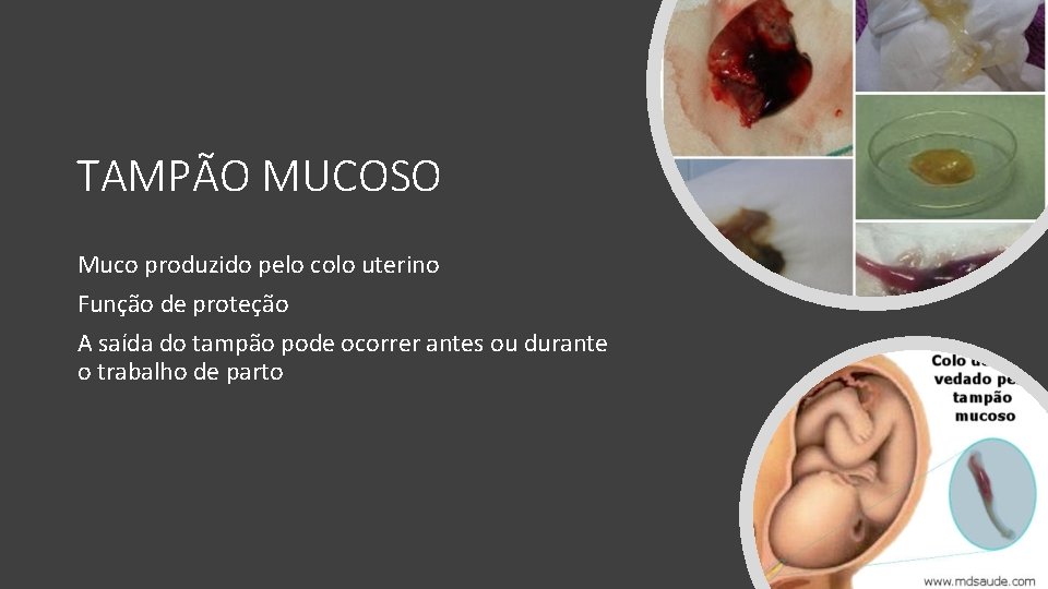 TAMPÃO MUCOSO Muco produzido pelo colo uterino Função de proteção A saída do tampão