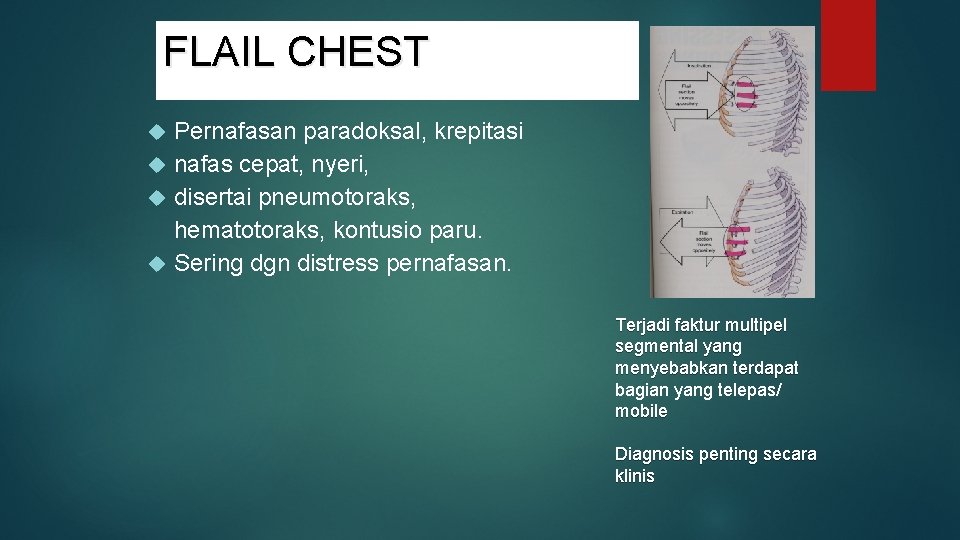 FLAIL CHEST Pernafasan paradoksal, krepitasi nafas cepat, nyeri, disertai pneumotoraks, hematotoraks, kontusio paru. Sering