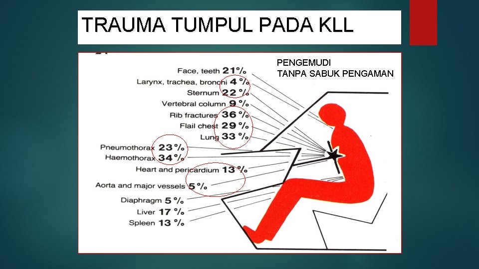 TRAUMA TUMPUL PADA KLL PENGEMUDI TANPA SABUK PENGAMAN 