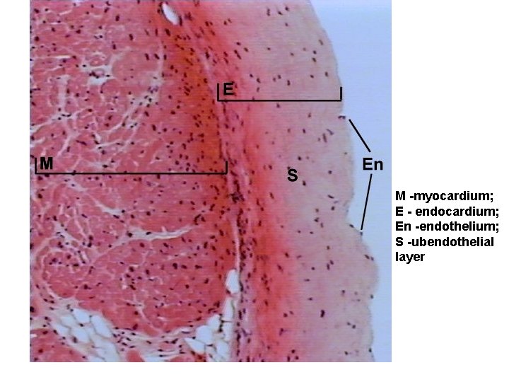 M -myocardium; E - endocardium; En -endothelium; S -ubendothelial layer 