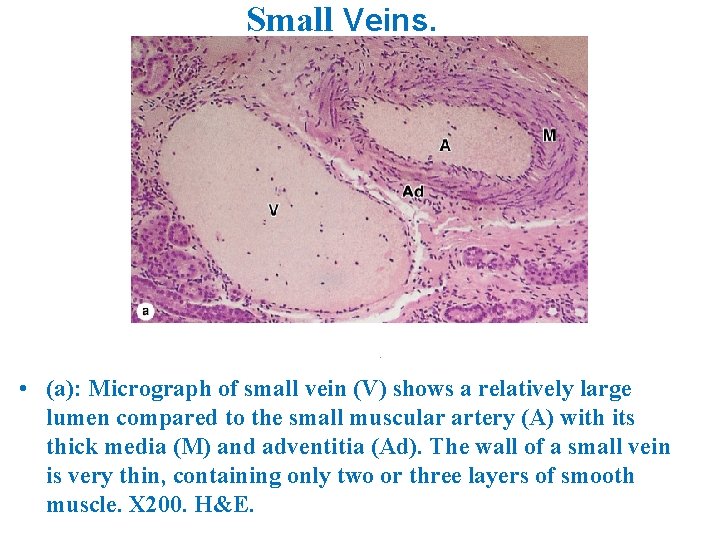 Small Veins. • (a): Micrograph of small vein (V) shows a relatively large lumen