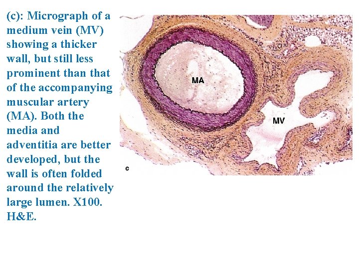 (c): Micrograph of a medium vein (MV) showing a thicker wall, but still less