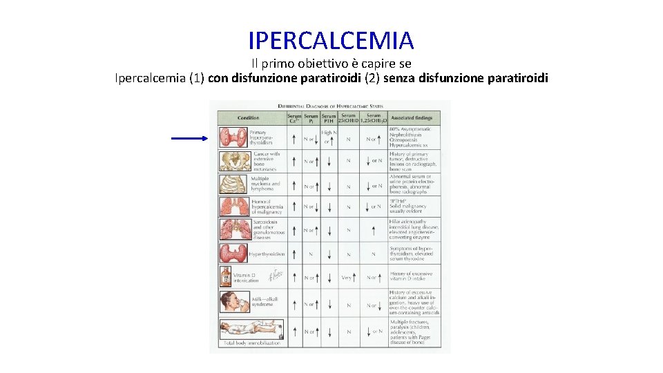 IPERCALCEMIA Il primo obiettivo è capire se Ipercalcemia (1) con disfunzione paratiroidi (2) senza