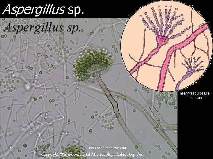 Aspergillus sp. healthresources. car emark. com education. med. nyu. edu 