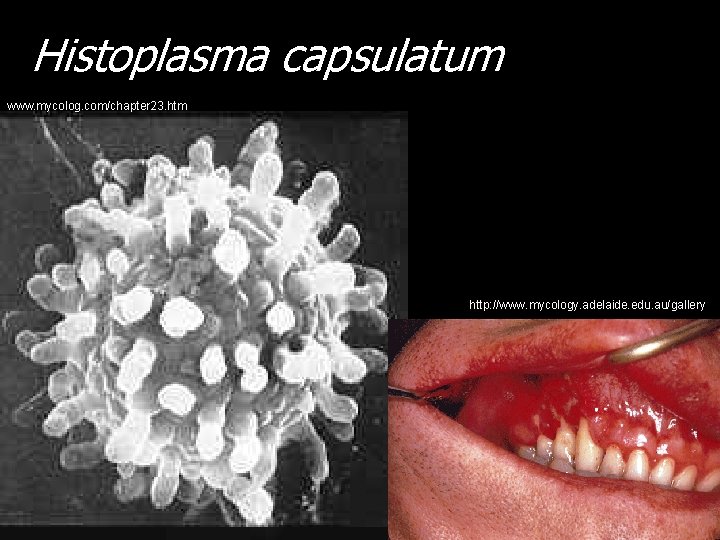 Histoplasma capsulatum www. mycolog. com/chapter 23. htm http: //www. mycology. adelaide. edu. au/gallery 
