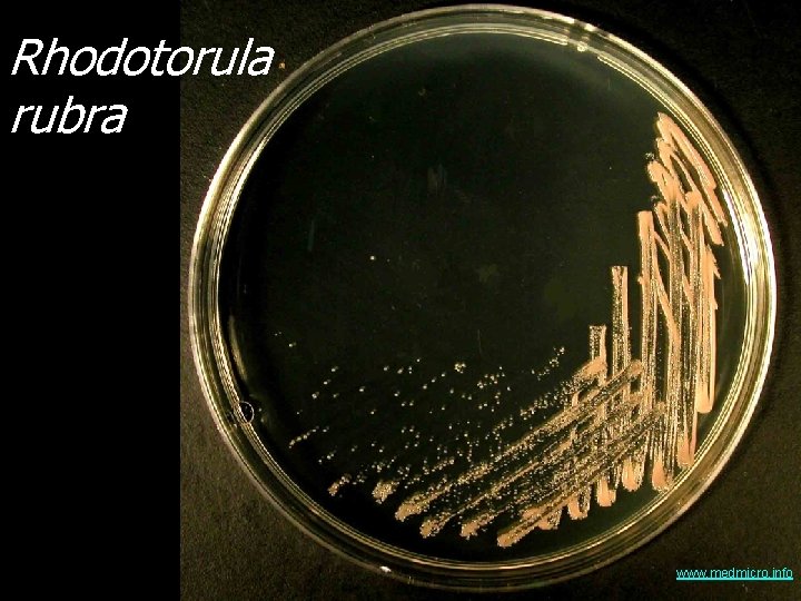 Rhodotorula rubra www. medmicro. info 