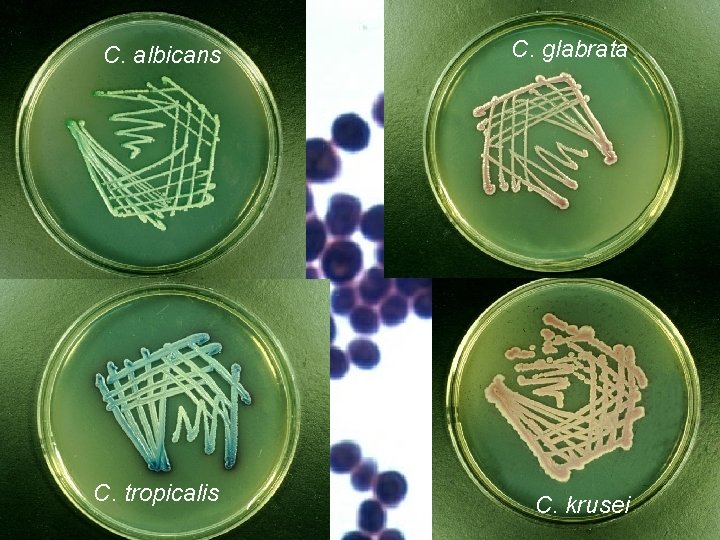 C. albicans C. glabrata C. tropicalis C. krusei 