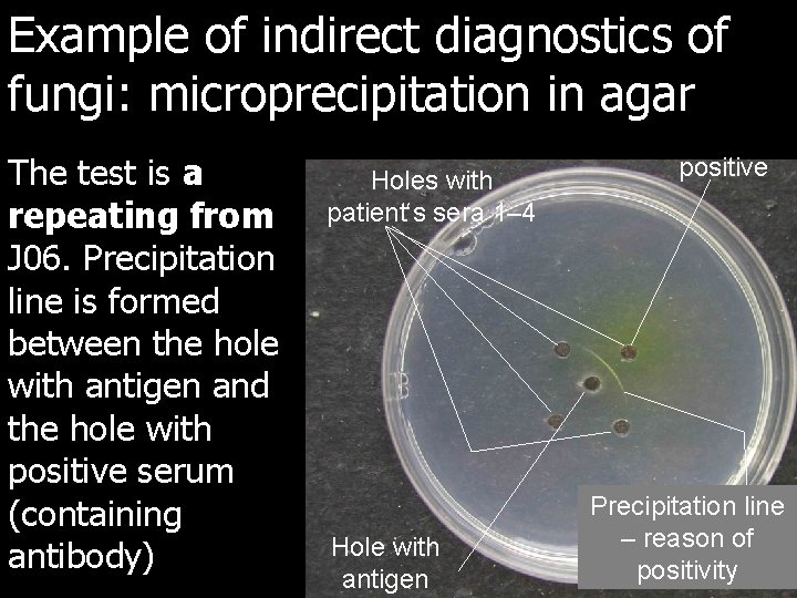 Example of indirect diagnostics of fungi: microprecipitation in agar The test is a repeating