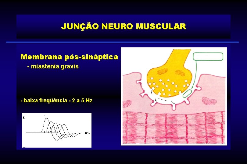 JUNÇÃO NEURO MUSCULAR Membrana pós-sináptica - miastenia gravis - baixa freqüência - 2 a