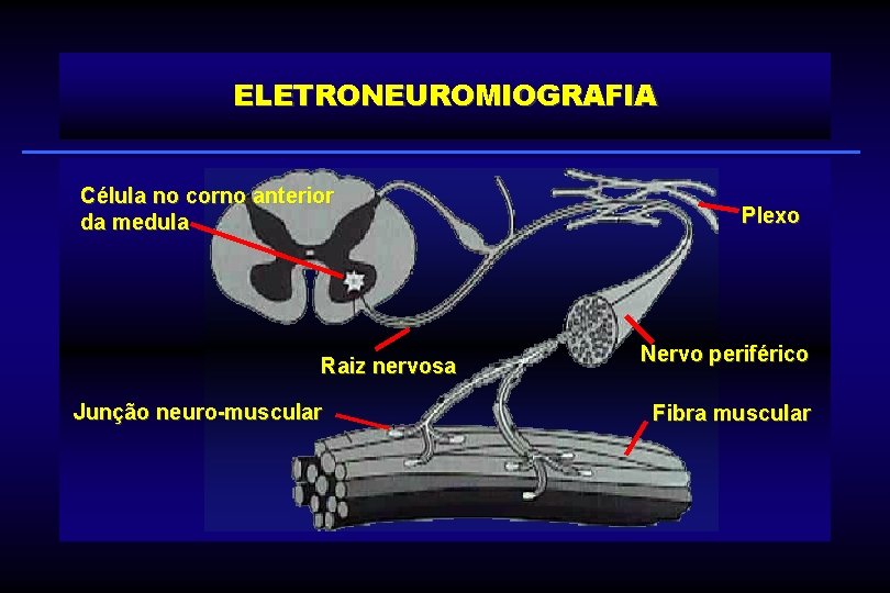 ELETRONEUROMIOGRAFIA Célula no corno anterior da medula Raiz nervosa Junção neuro-muscular Plexo Nervo periférico