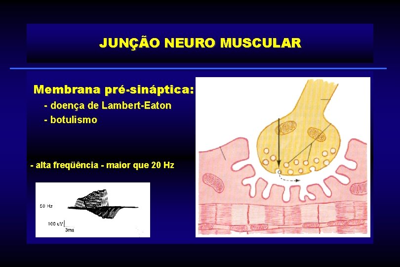 JUNÇÃO NEURO MUSCULAR Membrana pré-sináptica: - doença de Lambert-Eaton - botulismo - alta freqüência