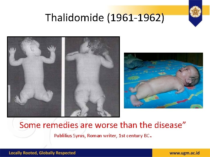 Thalidomide (1961 -1962) Some remedies are worse than the disease” Publilius Syrus, Roman writer,