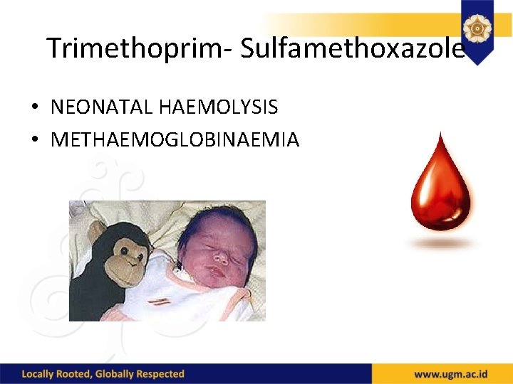 Trimethoprim- Sulfamethoxazole • NEONATAL HAEMOLYSIS • METHAEMOGLOBINAEMIA 
