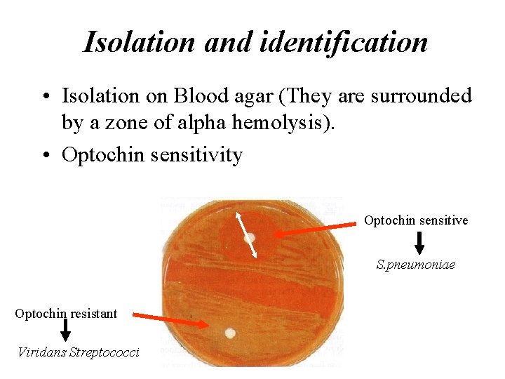 Isolation and identification • Isolation on Blood agar (They are surrounded by a zone