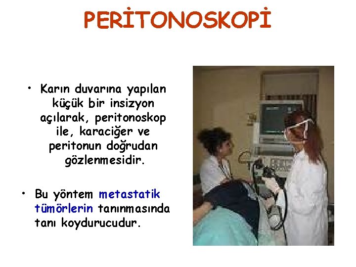 PERİTONOSKOPİ • Karın duvarına yapılan küçük bir insizyon açılarak, peritonoskop ile, karaciğer ve peritonun