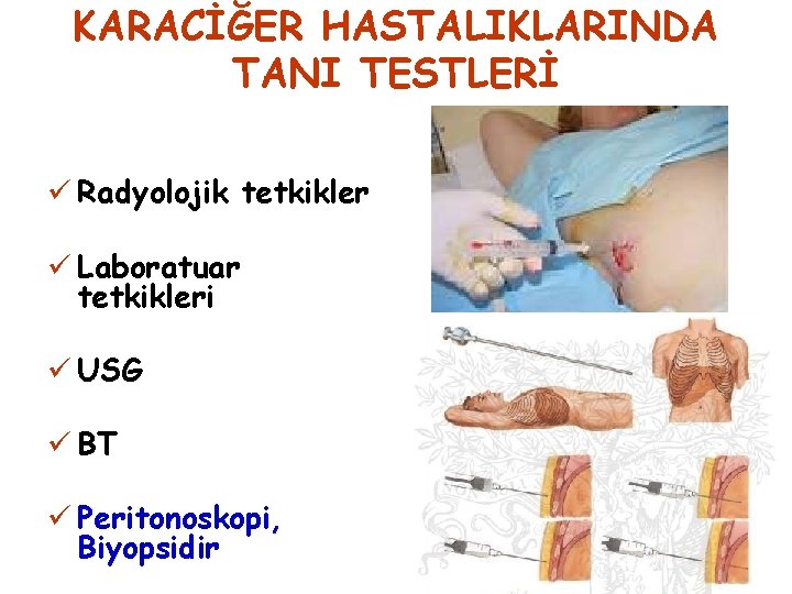 KARACİĞER HASTALIKLARINDA TANI TESTLERİ ü Radyolojik tetkikler ü Laboratuar tetkikleri ü USG ü BT