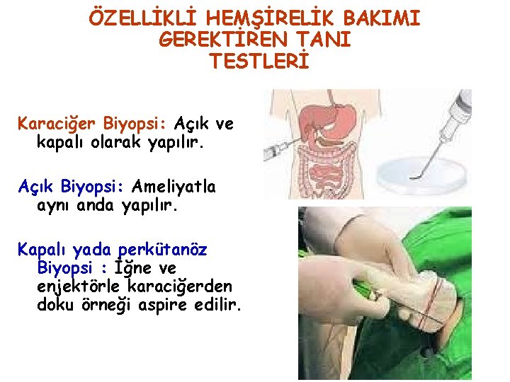 ÖZELLİKLİ HEMŞİRELİK BAKIMI GEREKTİREN TANI TESTLERİ Karaciğer Biyopsi: Açık ve kapalı olarak yapılır. Açık