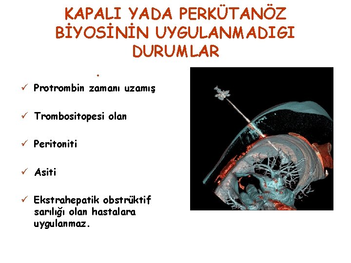 KAPALI YADA PERKÜTANÖZ BİYOSİNİN UYGULANMADIGI DURUMLAR. ü Protrombin zamanı uzamış ü Trombositopesi olan ü