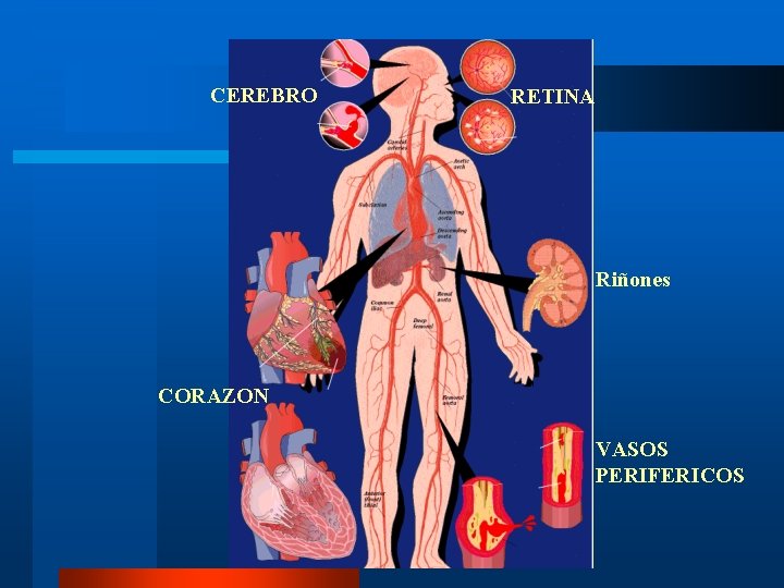 CEREBRO RETINA Riñones CORAZON VASOS PERIFERICOS CEREBRO RETINA Riñones CORAZON VASOS PERIFERICOS