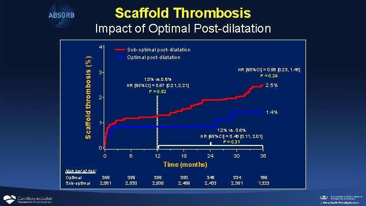 Scaffold Thrombosis Impact of Optimal Post-dilatation Scaffold thrombosis (%) 4 Sub-optimal post-dilatation Optimal post-dilatation