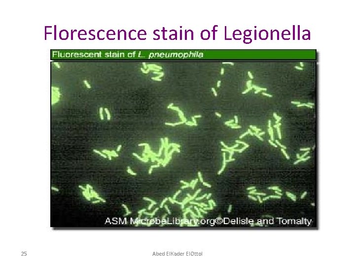 Florescence stain of Legionella 25 Abed El. Kader El. Ottol 
