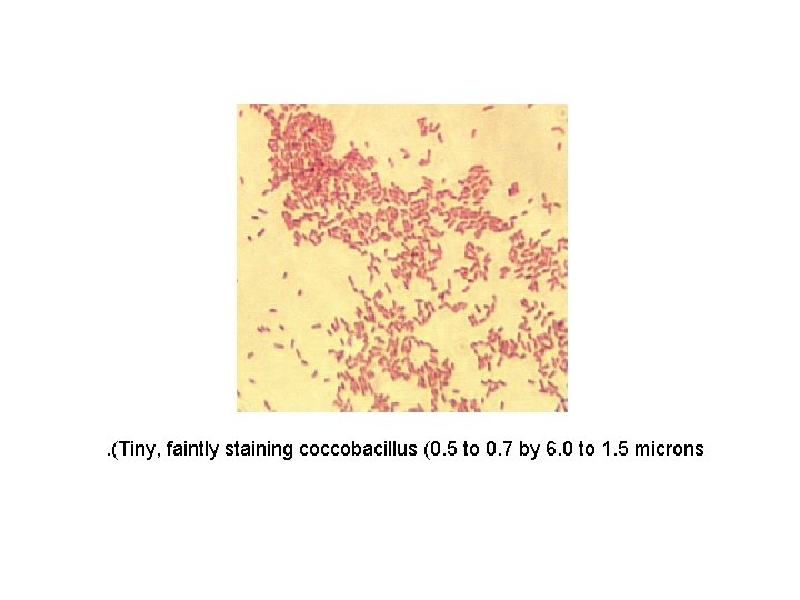 . (Tiny, faintly staining coccobacillus (0. 5 to 0. 7 by 6. 0 to